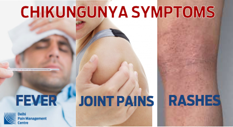 Skin Rashes In Chikungunya Skin Rashes In Chikungunya